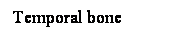 Cuadro de texto: Temporal bone

