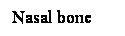 Cuadro de texto: Nasal bone 
